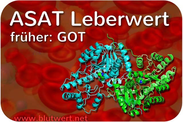 GOT Laborwert