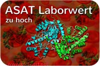 ASAT / GOT Wert erhöht / zu hoch