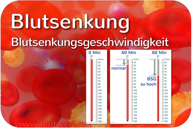 Blutkörperchensenkungsgeschwindigkeit, Blutwert BSG