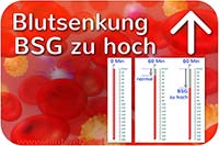 Blutkoerperchensenkungsgeschwindigkeit, Blutwert BSG zu hoch