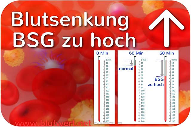 Blutkörperchensenkungsgeschwindigkeit, Blutwert BSG zu hoch