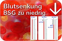 Blutsenkung vermindert, BSG-Wert zu niedrig