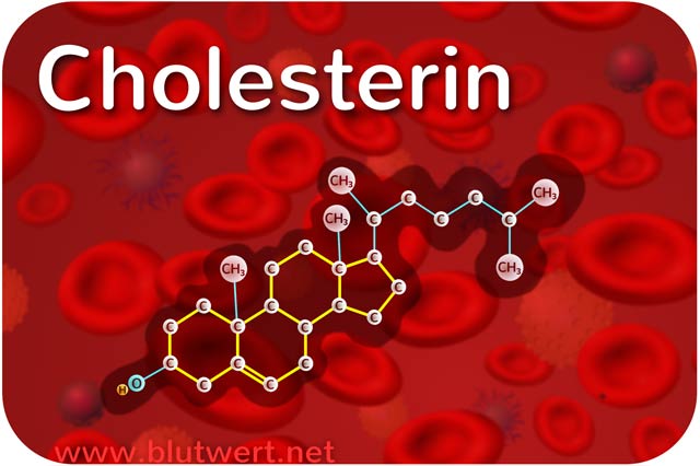 Cholesterin (Laborwert)