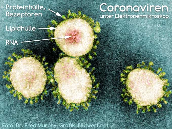 Coronaviren unter einem Elektronenmikroskop