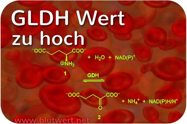 Laborwert GLDH erhöht / zu hoch