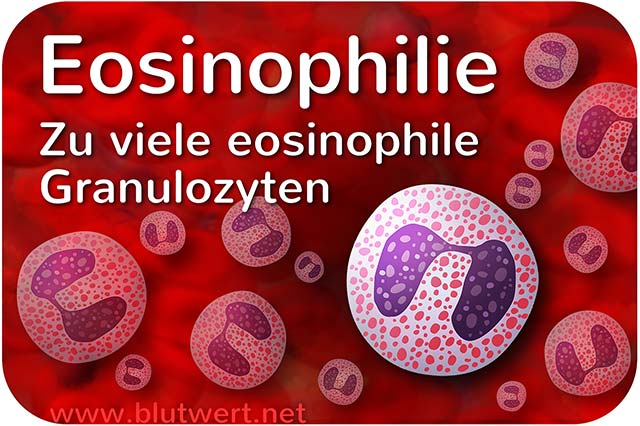 Eosinophilie: Zu viele eosinophile Granulozyten