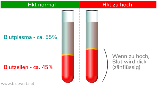 Hämatokrit zu hoch: Hoher Anteil von Blutzellen