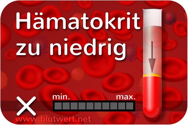 Hämatokrit zu niedrig (Blutwert Hkt vermindert)