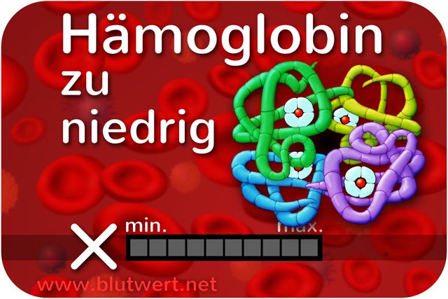 Hämoglobin Blutwert (Hb) vermindert, zu niedrig