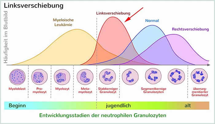 Linksverschiebung