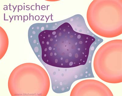 Atypischer Lymphozyt