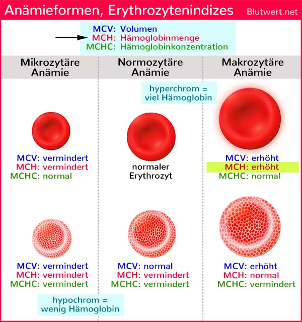 MCH-Wert erhöht, zu hoch: wahrscheinlich eine makrozytäre Anämie