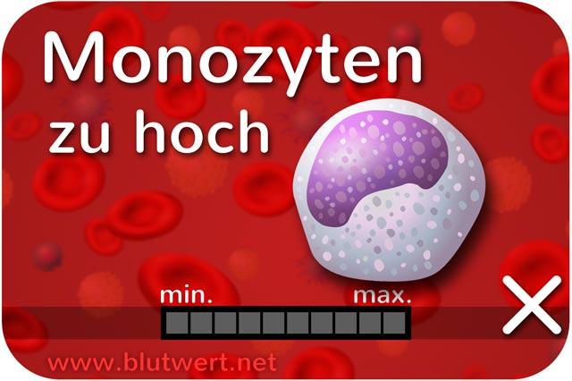 Zu viele Monozyten (Monozytose): Blutwert Mono erhöht, zu hoch
