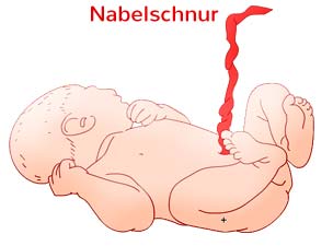 Nabelschnur