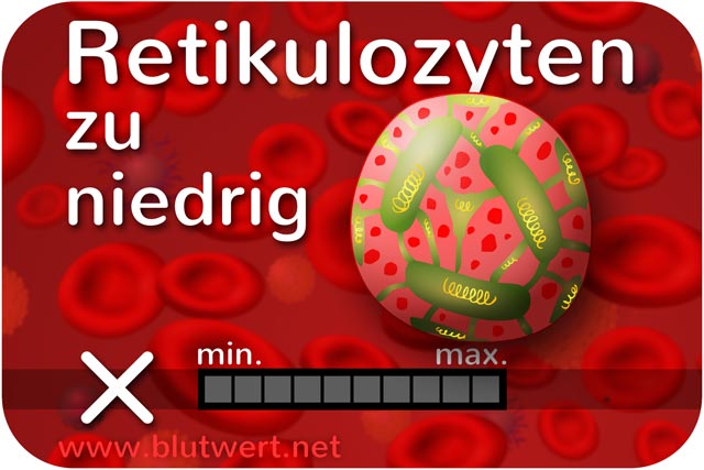Zu wenig Retikulozyten: Blutwert Reti vermindert, zu niedrig (Retikulozytopenie)