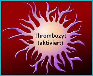 Thrombozyt (aktiviert)
