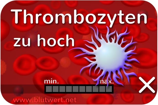 Thrombozyten zu hoch (Blutwert Thrombo erhöht)