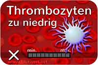 Zu wenig Thrombozyten: Blutwert vermindert, zu niedrig