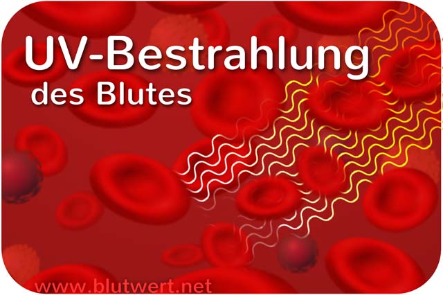 UV-Blutbestrahlung